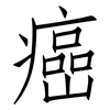 癌: Fangsongti