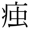 痋: Serifenschrift (Songti/Mingti) 痋: Serifenschrift (Songti/Mingti)